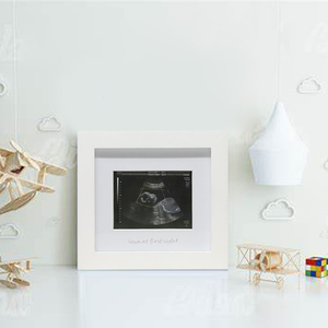 Cadre photo blanc tendance 2026 pour échographie de bébé, boîte de présentation de photos souvenir de grossesse pour la décoration intérieure - Product Image 3