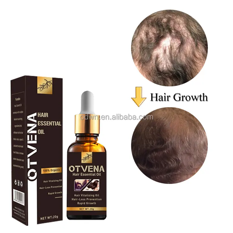 OTVENA, aceite de pelo de crecimiento salvaje de excelente calidad, revive los folículos pilosos, ayuda al crecimiento del cabello
