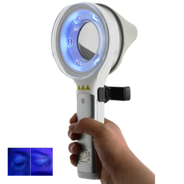 JYTOP Vitiligo KN-9000B Portable Dermatology LED Woods Lamp Medical Magnifier Skin Analyzer