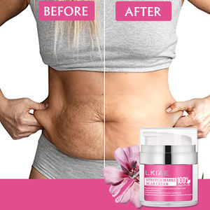 הסרת מתיחה lkiae קרם ויטמין טבעי בטוח & יעיל נגד לאחר לידה מתיחה סימן מתיחה קרם ויטמין טבעי - Product Image 2
