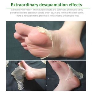 EFERO Aloe soluzione originale esfoliante riparazione calze allattanti maschera per i piedi rimuovere la pelle morta tacchi Peeling crema per i piedi - Product Image 5