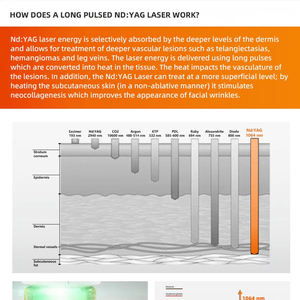 Alat perawatan laser, 1064 nm long pulse nd yag laser penghilang rambut medis dermatologi vaskular, peralatan kecantikan laser