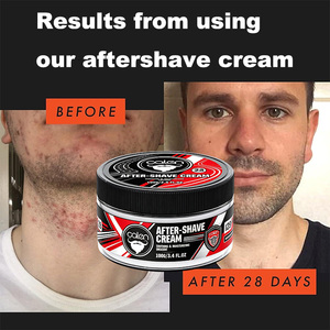 Luxfume Soin de la barbe <span class=keywords><strong>Après</strong></span>-<span class=keywords><strong>rasage</strong></span> : <span class=keywords><strong>Crème</strong></span> apaisante pour hommes, réduit les irritations et les rougeurs <span class=keywords><strong>après</strong></span> le <span class=keywords><strong>rasage</strong></span>, calme les peaux sensibles - Product Image 4