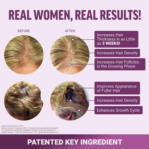 Bonbons gommeux à la vitamine pour la croissance des cheveux et la prévention de leur chute chez la femme, à base de plantes, faibles en sucre, 60 unités, pour adultes - Product Image 3