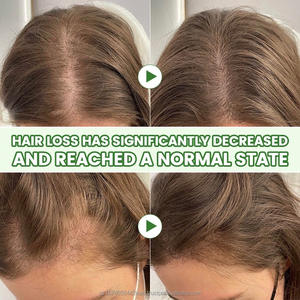 Soin des cheveux Huile Essentielle Pure 100% Huile Végétale Romarin Biologique Naturelle de Qualité Aromathérapie Marque Privée - Product Image 3