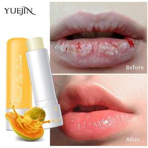 Etiqueta privada OEM Venta al por mayor Labios de bebé Bálsamo labial Hidratante Aclarador Aceite de coco mágico Bálsamo labial para terapia - Product Image 2