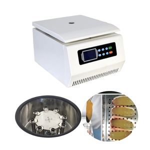 Centrífuga Clínica e de Laboratório de Baixa Velocidade 4000rpm 4/6x50ml 12x10ml Leve - Product Image 5