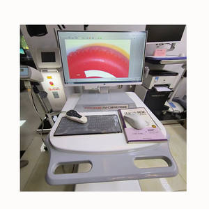 <strong>Colposcope</strong> Digital Imaging System Gynecological Colposcopy Camera <strong>Vaginal</strong> Equipment Digital <strong>Colposcope</strong> for Gynecology - Product Image 2