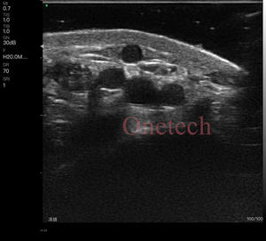 Échographe <span class=keywords><strong>portable</strong></span> sans fil C37G Clinic à haute fréquence pour l'analyse des couches et structures du visage, scanner d'imagerie couleur pour interventions esthétiques - Product Image 6