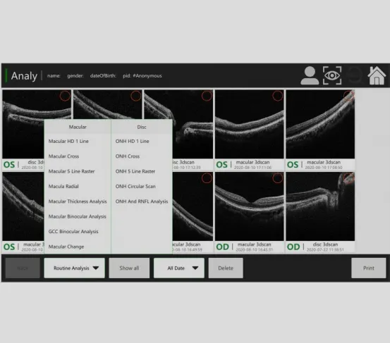 Göz doktoru için oftalmik ekipmanlar OCT-500 optik tutarlılık tomografi makinesi yerleşik bilgisayar eki