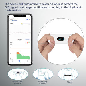 Viatom Machine <span class=keywords><strong>Ecg</strong></span> portable 30s-15mins Suivi <span class=keywords><strong>Ecg</strong></span> en temps réel Batterie longue durée <span class=keywords><strong>Holter</strong></span> portable <span class=keywords><strong>Ecg</strong></span> - Product Image 3