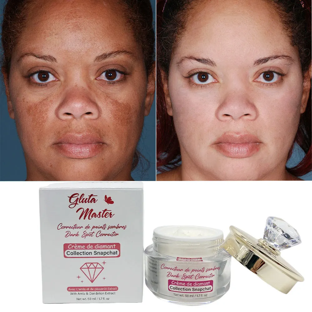 Gluta Master Diamond Glow Dark Spot Corrector Crema facial con glutatión Super Lightening Black Skin Shine Beauty Cream