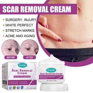 Crema Facial Reparadora y Aclarante de 50g con Vitamina E y Aceite de Jojoba para Piel Quirúrgica y Traumatizada con Eliminación de Cicatrices - Product Image 2