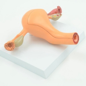 Le modèle de système reproducteur anatomique féminin en PVC pour l'éducation médicale comprend l'utérus, le vagin et l'ovaire avec pathologie - Product Image 5