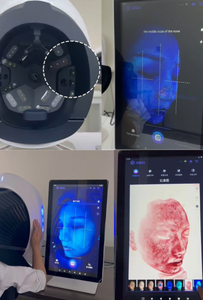 Analyseur de peau IA 2026 : Scanner facial et appareil d'observation cutanée avec test d'allergie, prise EU/JP - Product Image 4