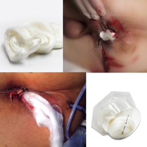 Roosin memulihkan Calcicare kalsium <span class=keywords><strong>Alginate</strong></span> perawatan luka berpakaian - Product Image 5