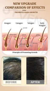 OTVENA <span class=keywords><strong>Olio</strong></span> di Cocco 100% Biologico per Riparazione Profonda e Lisciatura dei Capelli Secchi e Ricci, Prevenzione Caduta Capelli, 4 Settimane, 20ml - Product Image 2