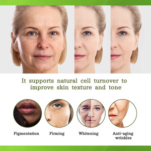 Siero Viso al Retinolo 2,5% 10mL con Vitamina A/C/E ed Estratti Vegetali per Schiarire, Illuminare, Ridurre Macchie, Pigmentazione, Linee Sottili e Rughe - Product Image 4