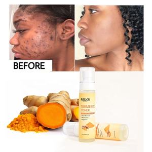 Çam kozalağı özü aydınlatma Anti akne cilt bakımı zerdeçal su spreyi yüz toniği - Product Image 2