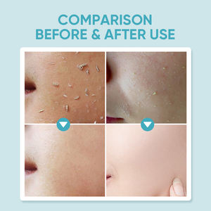 Vente en gros Meilleure crème faciale exfoliante hydratante blanchissante <span class=keywords><strong>pour</strong></span> les femmes éliminant les points noirs et crème éclaircissante <span class=keywords><strong>pour</strong></span> le visage - Product Image 5