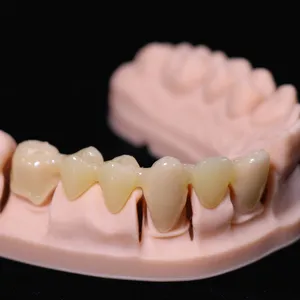 Résine de couronne temporaire avec résine d'impression 3D couleur A1 A2 et A3 pour les laboratoires dentaires