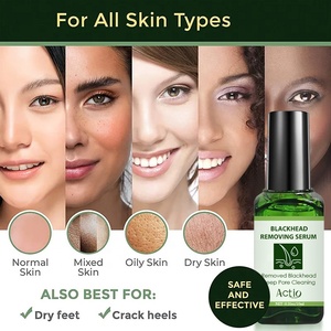 Suero para eliminación de espinillas, aceite de té verde, removedor de espinillas, máscara para eliminación de espinillas, poros, Barbilla y cara - Product Image 5