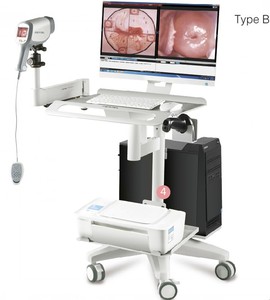 Digital medis pemeriksaan glikologic kamera HD <span class=keywords><strong>Video</strong></span> Vagina kamera untuk ginekologi Vagina endoskopi - Product Image 6