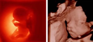 Máy siêu âm Mindray Z50S, thương hiệu Mindray, máy siêu âm di động, máy siêu âm Doppler màu, máy siêu âm xách tay - Product Image 5