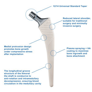 Prostesis Sendi Penggantian Pinggul <span class=keywords><strong>Total</strong></span> Parsial Dual Mobility Artroplasti dengan Cup Acetabular Bersemen Primer UHMWPE Kelas CE III 5+ - Product Image 6