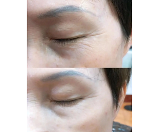 Marque privée <span class=keywords><strong>Anti</strong></span>-rides et cernes Réduction rapide Crème contour des yeux <span class=keywords><strong>Anti</strong></span>-rides instantané pour le visage - Product Image 2