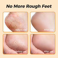 Baume Réparateur Talons Fissurés à la Cire d'Abeille OEM Personnalisé, Huile d'Olive Hydratation Intense, Exfoliant et Hydratant pour les Pieds, Marque Privée
