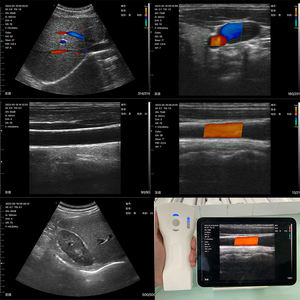 <span class=keywords><strong>Probe</strong></span> Ultrasound transrektal Portabel medis penuh Digital <span class=keywords><strong>USB</strong></span> Wifi <span class=keywords><strong>Probe</strong></span> Ultrasound Linear nirkabel - Product Image 5