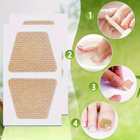 Patch de Correction d'Ongles Incarnés en Forme de T, Autocollant Flexible et Sûr, Soutien d'Alignement, Prévention, Marque Privée