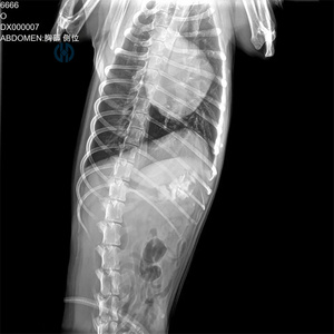 Sistemas de Rayos X Manhua, Detector de Panel Plano Inalámbrico de 17x17, Máquina de Rayos X para Mascotas Opcional con Kit de Máquina de Rayos X <span class=keywords><strong>Veterinaria</strong></span> Portátil - Product Image 5