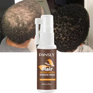 Somente 20 garrafas 30ml ervas anti-dandruff, com BT-GLSa1 óleo de crescimento capilar, tratamento do cabelo, spray para crescimento do cabelo para homens e mulheres