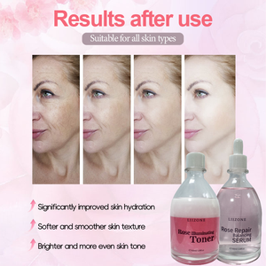 OEM ODM Personalizar la piel opaca Brillo Rosa Tónico Hidratante Profundo Calmante Reparación Suero facial - Product Image 4