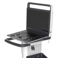 Sonoscape E2V diagnostic précis et efficace calcul automatique échographie vétérinaire doppler couleur haute résolution