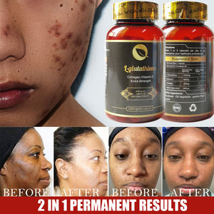 Eigen Merk Aangepaste Groothandel Glutathion <span class=keywords><strong>Whitening</strong></span> <span class=keywords><strong>Capsules</strong></span> Verminderen Melanine Antioxidant Glutathion <span class=keywords><strong>Whitening</strong></span> <span class=keywords><strong>Capsules</strong></span> - Product Image 5