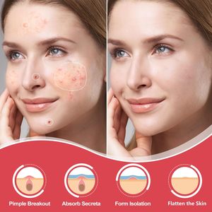 Nouvelles Patchs Anti-Acné de Haute Qualité pour Femmes - Product Image 3