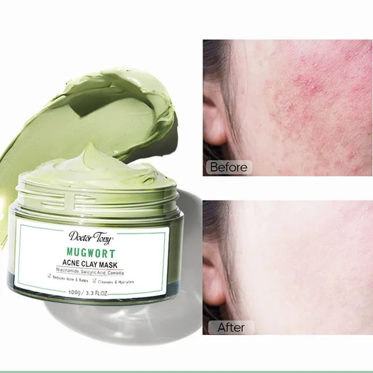 Vente en gros Marque privée Soin naturel de la peau Nettoyage en profondeur Masque facial éclaircissant Masque de boue à l'argile anti-acné à l'armoise