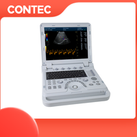 Appareil d'échocardiographie CONTEC CMS1700B Échocardiogramme Échographie Doppler couleur portable