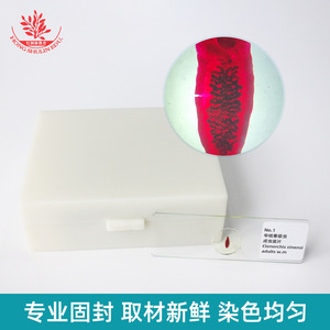 25 diapositivas de muestras microscópicas de parásitos, con fijación estándar para investigación de parasitología clásica. - Product Image 4