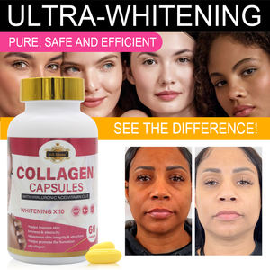 كبسولات الكولاجين ذات العلامات التجارية الخاصة، منتج تجميلي لتفتيح البشرة وإشراقها، أقراص مكملات الكولاجين لتبييض البشرة - Product Image 4