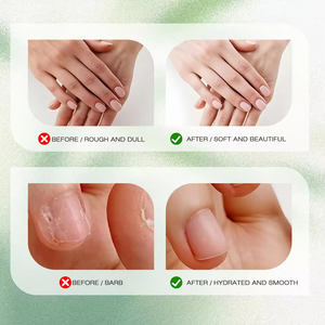 Bálsamo de Aceite de Almendras Dulces y Sebo de Res Personalizado, Crema Hidratante y Nutritiva para Todo el Cuerpo, Alivio del <span class=keywords><strong>Dolor</strong></span>, Crema de Manos Hidratante a Granel - Product Image 4