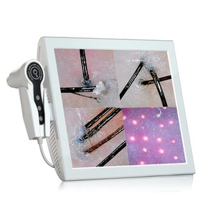 Nouveaux Scanners d'Analyse Capillaire Pratiques, Analyseur de Peau Numérique HD 15 Pouces pour Usage Domestique, <span class=keywords><strong>Scanner</strong></span> Haute Définition - Product Image 1