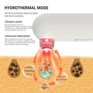 Extractor de Puntos Negros y Espinillas, Herramienta de Eliminación de Acné con Burbujas de ABS, Limpiador de Poros con Vacío de Agua Fría y Caliente - Product Image 3