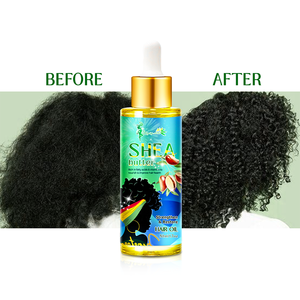 Ce n'est pas grave si vous noir ou blanc beurre de karité cheveux réparation huile sérum renforcer le cuir chevelu ensemble de soins capillaires - Product Image 6