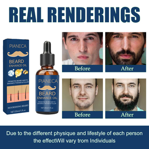 Bellezza <span class=keywords><strong>uomo</strong></span> ricrescita barba crescita olio essenziale Private Label barba crescita olio per la cura degli uomini prodotto OEM - Product Image 3