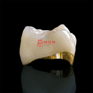 Apariencia Natural Impresión 3D Pfm Co-Cr Aleación Metal Cerámica Coronas dentales fijas comunes Puente Implantes Dentaduras postizas - Product Image 2