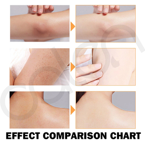 Saponetta naturale per la pelle alla curcuma per viso e corpo per macchie scure e aree intime efficace per la cura delle ascelle - Product Image 6
